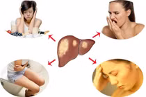 Bác sĩ chỉ rõ dấu hiệu "cầu cứu" của gan, cần thải độc, thanh lọc ngay