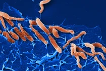 Vi khuẩn H.P gây bệnh gì?