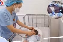Cứu sống trẻ 22 ngày tuổi nguy kịch do bị thủy đậu toàn thân