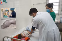 Nhiều trẻ đang chơi đùa đột ngột mắc bệnh lồng ruột