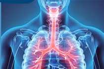 Bác sĩ mách cách phòng bệnh COPD bảo vệ lá phổi cuộc đời