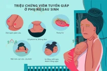 Viêm tuyến giáp sau sinh dễ nhiễm độc, suy giáp