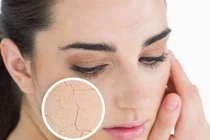 Trẻ hoá làn da cho khuôn mặt xinh đẹp