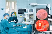 Lần đầu phẫu thuật tạo hình xương con tai giữa tại BV Nhi Thanh Hoá