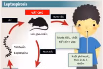 Nhiều trẻ nhiễm xoắn khuẩn Leptospira do chuột cắn