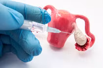 Bác sĩ chỉ rõ cách ăn uống, sinh hoạt sau khi tiêm kích trứng