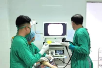 Gắp viên thuốc còn nguyên vỏ mắc kẹt trong thực quản cụ bà 88 tuổi