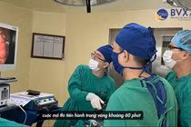 Thủng ruột vì vừa ngậm tăm xỉa răng vừa uống nước