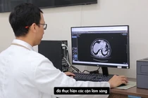 Đột nhiên đi tiểu ra máu, vào viện phải cắt thận do u xâm lấn