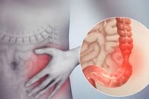 Cách chữa Hội chứng ruột kích thích không khỏi và rất dễ tái lại