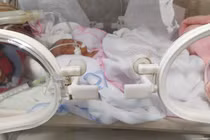 Điều trị thành công sơ sinh cực non tháng mới 27 tuần 