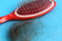 Rụng tóc do bệnh tuyến giáp?