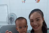 Tạo hình thành công ngón tay cái cho bệnh nhi Lào bị di chứng bỏng nặng nề