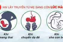 Dự phòng lây truyền HIV từ mẹ sang con như thế nào?