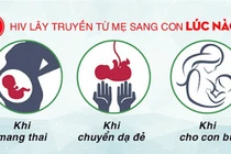Dự phòng lây truyền HIV từ mẹ sang con như thế nào?