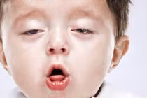 Bé trai 1 tháng tuổi viêm phổi nặng vì ho gà: Cách gì phòng tránh?