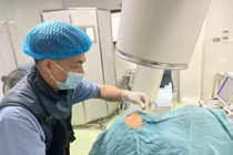 8 phút đốt sóng cao tần chấm dứt cơn đau dây thần kinh V 