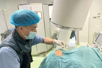 8 phút đốt sóng cao tần chấm dứt cơn đau dây thần kinh V 