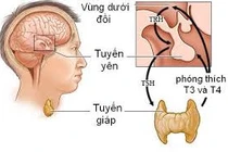 Vì sao suy giáp gây tăng cân mất kiểm soát?