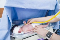 9h sau sinh trẻ đã phải điều trị tích cực vì vàng da do huyết tán
