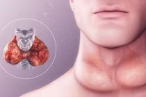 Ung thư tuyến giáp tái phát ở đâu?