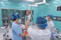 3 tuần ho khạc ra mủ, không ngờ do hạt lạc trong phế quản phối