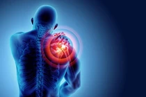 Các bệnh lý khớp vai thường gặp ở người trung niên, cao tuổi đang tăng cao