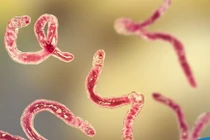 7 lời khuyên từ bác sĩ để phòng tránh nhiễm ký sinh trùng