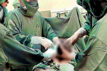 Ca phẫu thuật cứu bệnh nhân thuyên tắc ối - Ảnh BVCC