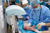 Bé đầu tiên thông tim trong bào thai ra đời khỏe mạnh