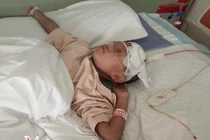 Địa chỉ vàng: Các bệnh viện cấp cứu đột quỵ trẻ em