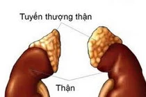 Dấu hiệu phát hiện sớm suy thượng thận cấp