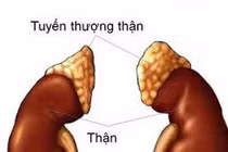 Dấu hiệu phát hiện sớm suy thượng thận cấp