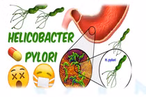 Có cần phải quá lo lắng với vi khuẩn H.P?