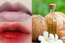 Bật mí 4 cách 'đánh bay' thâm môi bằng dầu dừa hiệu quả, an toàn