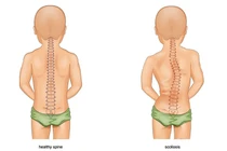 10 thói quen ‘hủy hoại’ cổ và lưng bạn cần sửa ngay