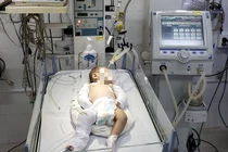 Bé gái 2 tháng tuổi chấn thương sọ não, hôn mê sâu nghi bị bạo hành