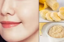 Bỏ túi ngay 5 công thức mặt nạ chuối giảm nếp nhăn, trẻ hóa da