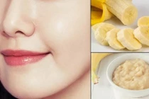 Bỏ túi ngay 5 công thức mặt nạ chuối giảm nếp nhăn, trẻ hóa da