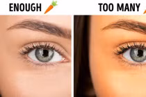 Sai lầm khi ăn kiêng khiến da bị vàng, sạm