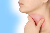 Nguyên nhân tái viêm họng 