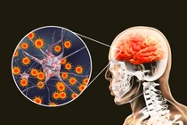 Thường xuyên làm điều này vào buổi trưa có thể giúp trẻ hóa não bộ