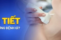 Điểm danh ngay 5 bệnh nội tiết thường gặp