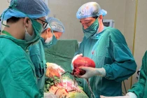 Đi khám vì rong kinh, bụng to người phụ nữ phát hiện u xơ tử cung