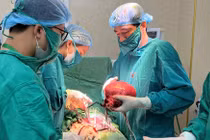 Đi khám vì rong kinh, bụng to người phụ nữ phát hiện u xơ tử cung