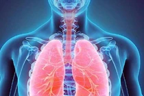 5 loại trái cây được ví như 'máy hút bụi' dành cho phổi