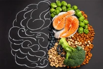 9 thực phẩm giúp tăng cường tuần hoàn máu não 