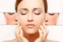 Bí quyết chăm sóc da nhạy cảm không phải ai cũng biết