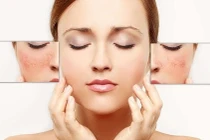 Bí quyết chăm sóc da nhạy cảm không phải ai cũng biết