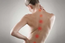 Cong vẹo cột sống và những hậu quả nghiêm trọng